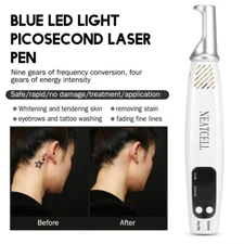 Hot Selling Blue Light Laser Pen Tattoo Remover |Dark Spot Scar Removing Machine