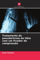 Sami Sellami (U. A.) | Tratamento Da Pseudartrose Da TíBia Com Um Fixador De...