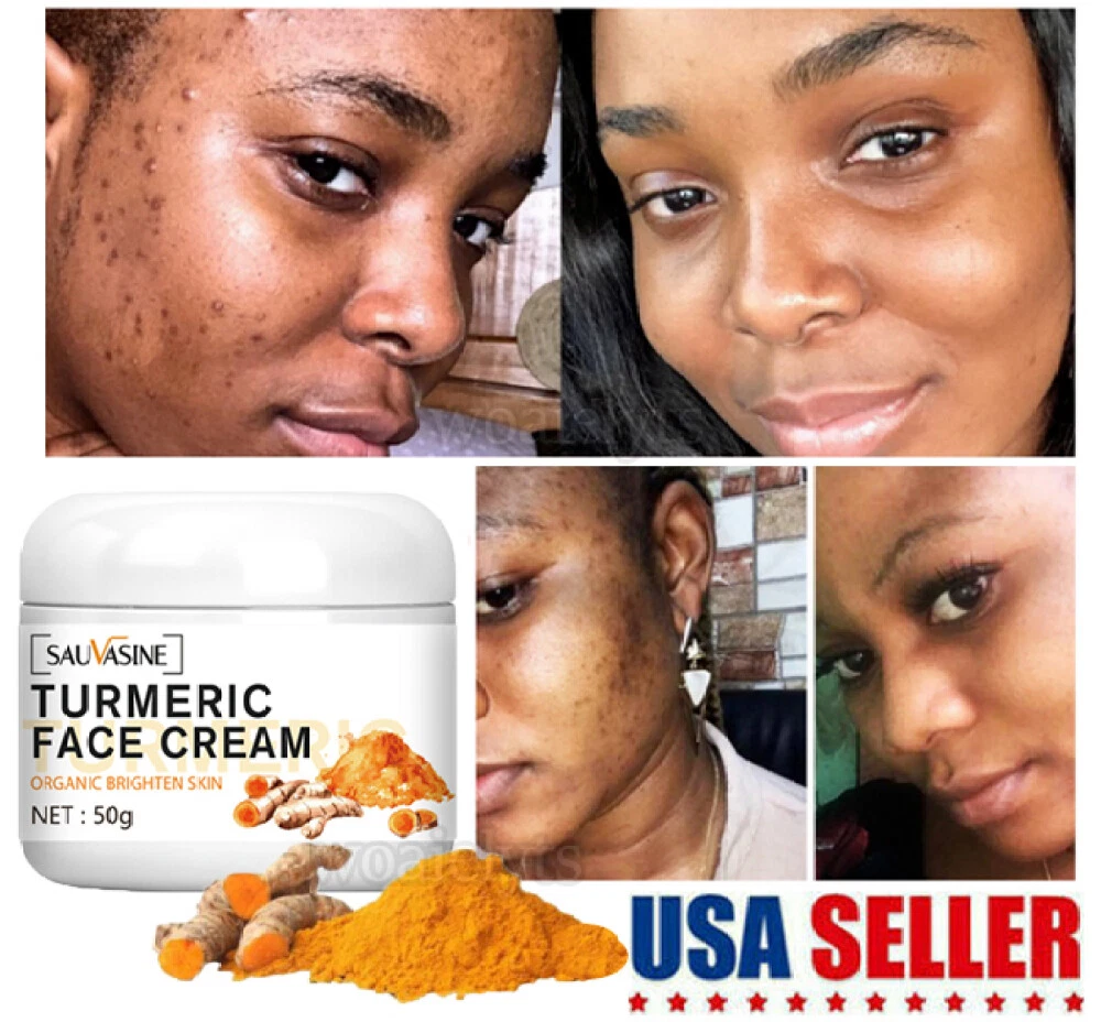 Face Cream For Dark Spots