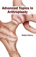 Robert Berry | Advanced Topics In Arthroplasty | Buch | Englisch (2015)