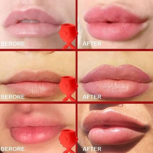 Schmerzlos Lippen füller Werkzeug Silikon Lippen maske Lippen-Plumper Frauen - Bild 4 von 7