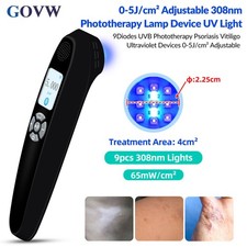 9Diodes 308nm UV Light Therapy for Ultraviolet Therapy Hands Face Skin Disorders