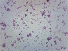 25PK Proteus Vulgaris Smear - Prepared Slides - 75x25mm - Eisco Labs