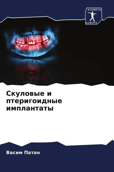 Vasim Patan | Skulowye I Pterigoidnye Implantaty | Taschenbuch | Russisch (2022)-image