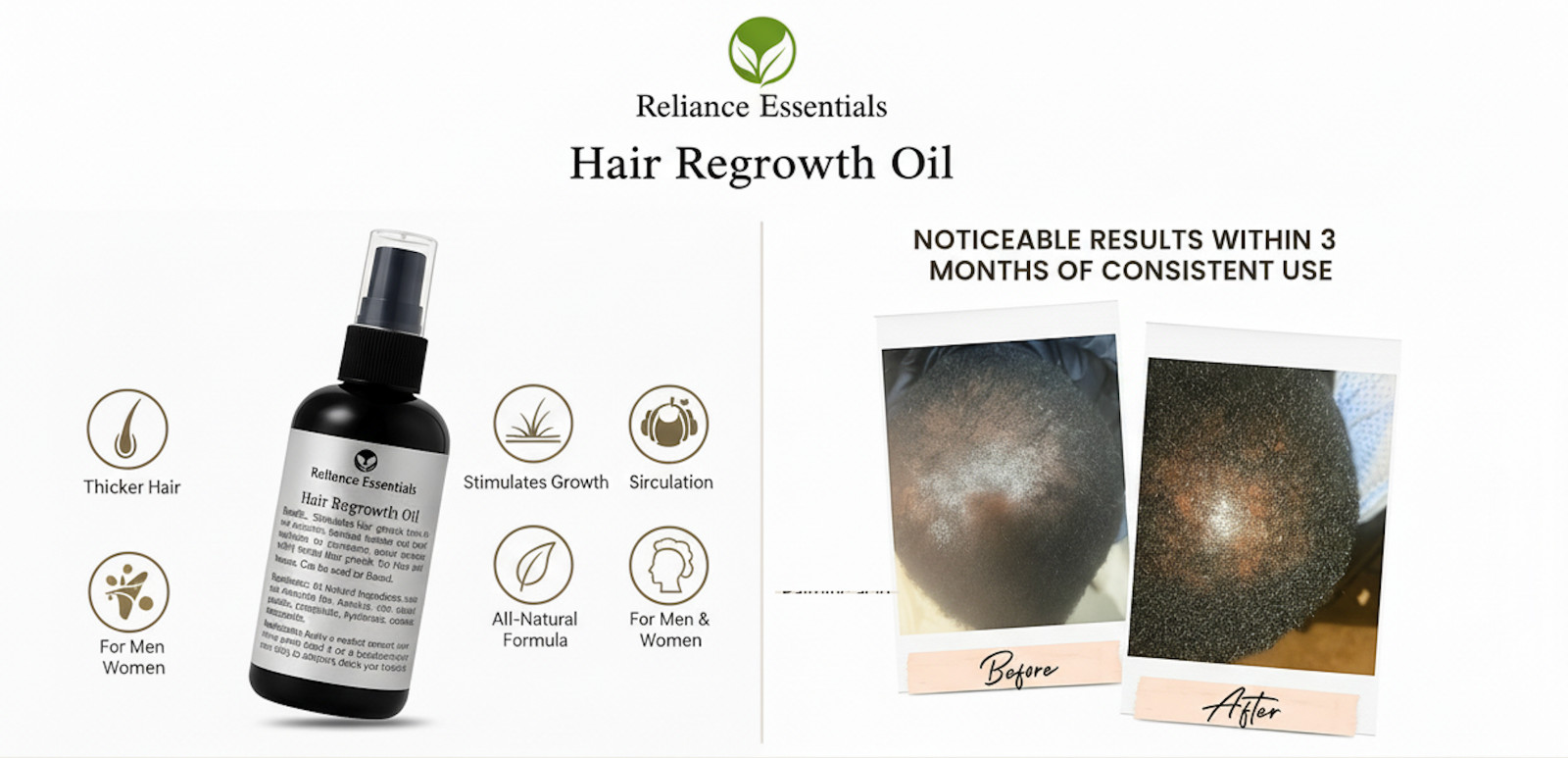 Reliance Essentials Hair Growth Oil &ndash; Natural Regrowth & Scalp Nourishment 4oz