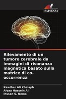 Rilevamento Di Un Tumore Cerebrale Da Immagini Di Risonanza Magnetica Basato...