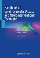 Handbook Of Cerebrovascular Disease And Neurointerventional Technique John ...