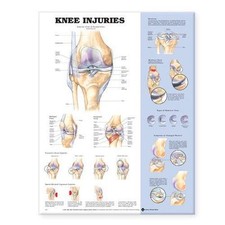 Knee Injuries Anatomical Chart, Paperback by Anatomical Chart Company EDT , ...