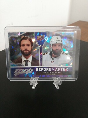 2021-22 Upper Deck MVP Before And After Aaron Ekblad Florida Panthers BA-20 NHL