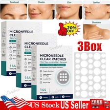 3box 432pcs Curalona Microneedle Patches, Skin Tag Wart Acne Remover Patches USA