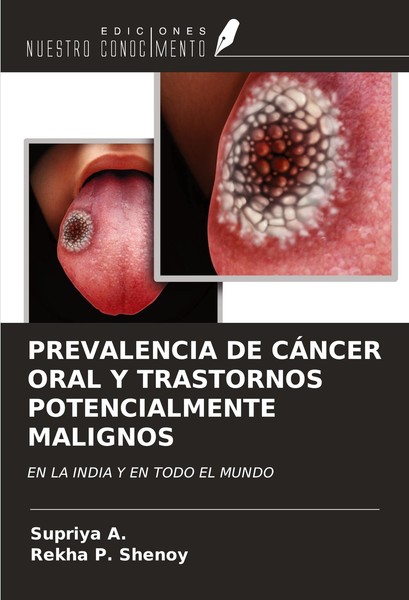 Prevalencia DE CÁNcer Oral Y Trastornos Potencialmente Malignos Supriya A.-image