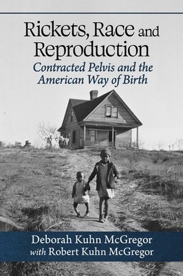 Rickets, Race And Reproduction: Contracted Pelvis And The Am...