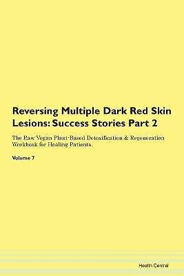 Reversing Multiple Dark Red Skin Lesions, ,  Paper