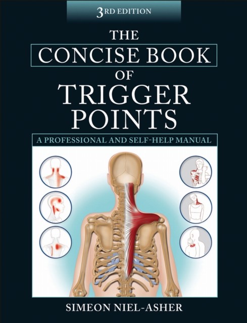 The Concise Book of Trigger Points by Simeon Niel-Asher (Paperback, 2014) - Image 6