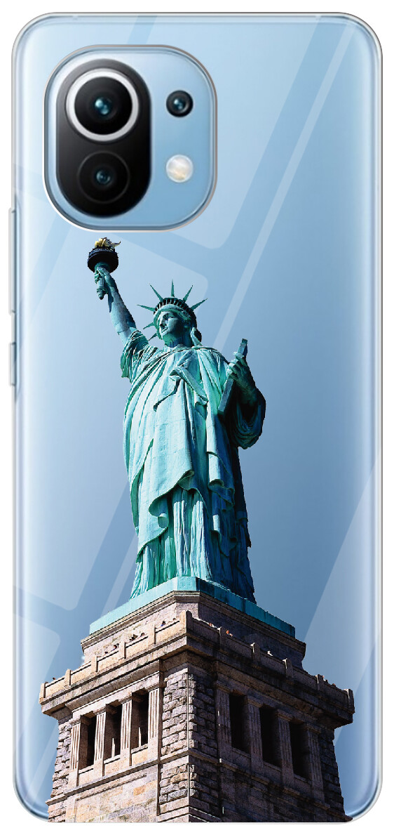 Custodia Trasparente Anti-ingiallimento Per Motorola Moto G15 / G15 Power – Silicone Morbido + Retro Rigido – Antiurto Militare