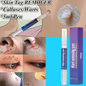 2 Crèmes Pour Enlever Les Skin Tags (excroissances) - Naturelle Ayurvedique - Neuf - Exp. 2027