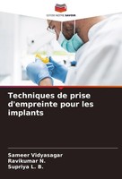 Techniques De Prise D'empreinte Pour Les Implants Supriya L. B.