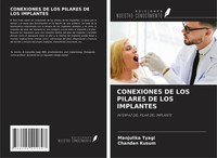 Manjulika Tyagi (U. A.) | Conexiones De Los Pilares De Los Implantes | Buch