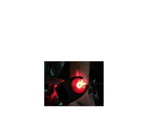 Vein Light Viewer Finder High LED Intensity Hand Held Portable Battery Operated - Picture 7 of 8