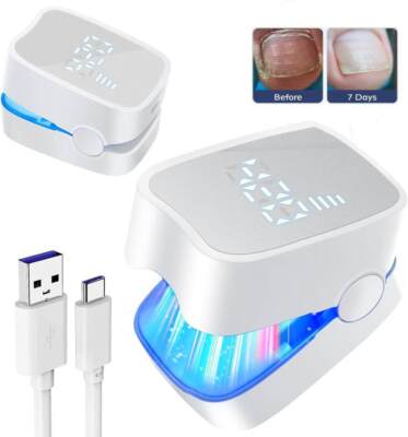 Laser Nagelpilz Fungal Nail Therapie Lasergerät Fungus Lazer für Heimgebrauch D