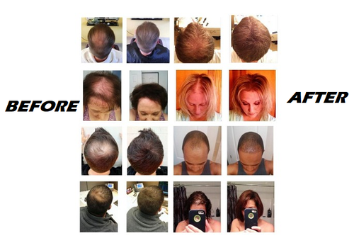 3 Hair Building Fibers Australian Brand 100% Cotton Hair Loss Balding Concealer - Picture 10 of 16