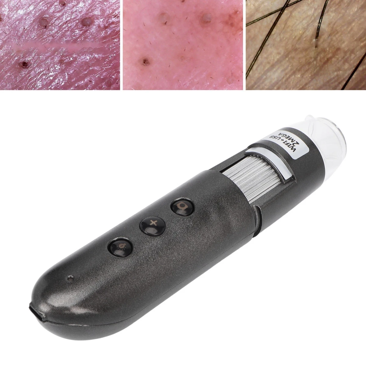 200X Magnification Digital Skin Hair Scalp Detector 2MP WiFi USB High Definition