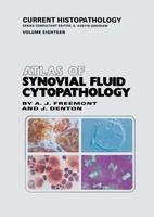 Atlas Of Synovial Fluid Cytopathology Anthony J. Freemont (U. A.) Taschenbuch