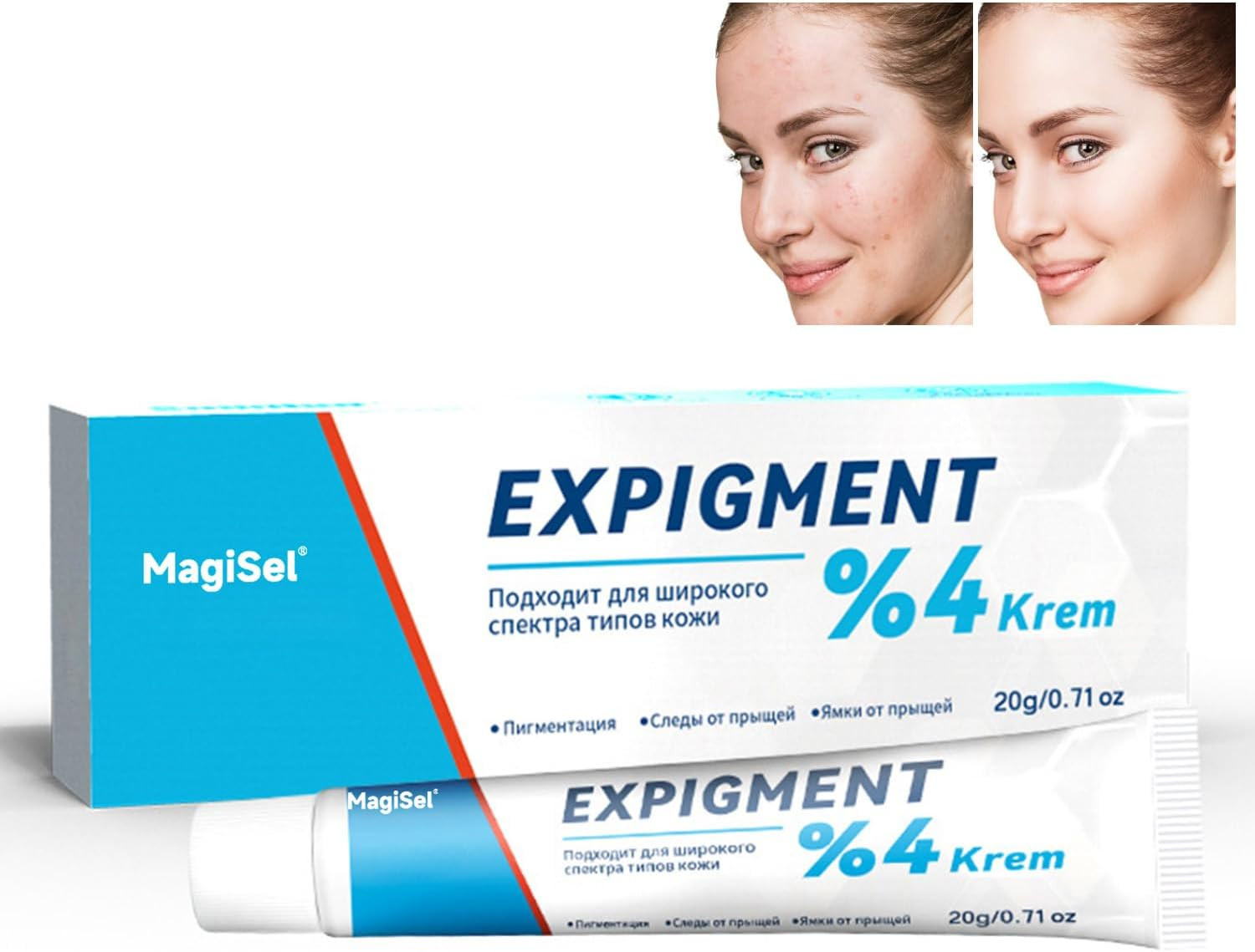Trattamento Acne 20G: Crema Brufoli Viso Concentrata per Imperfezioni