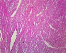 Spinal Ganglion and Nerve