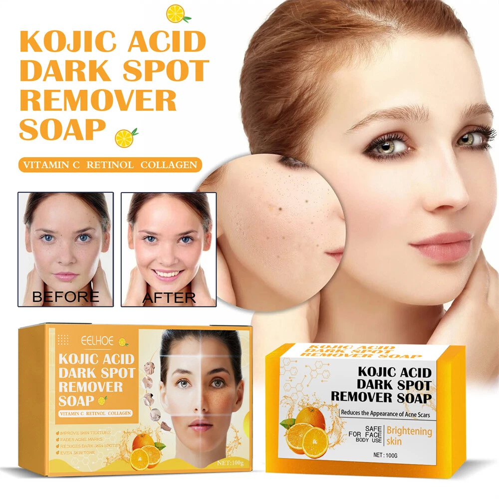 Soap for acne scars deals