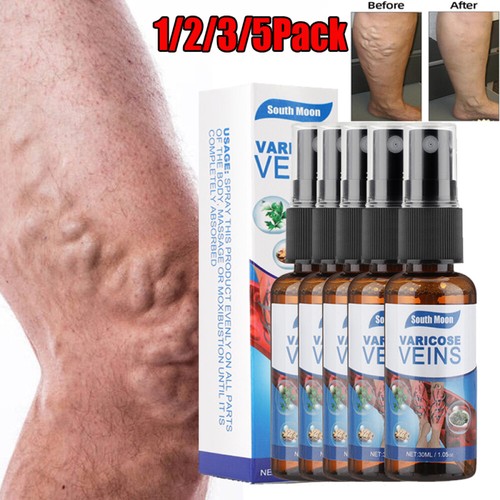Herbal Vasculitis Treatment Vein Care Repairing Cream Legs Varicose