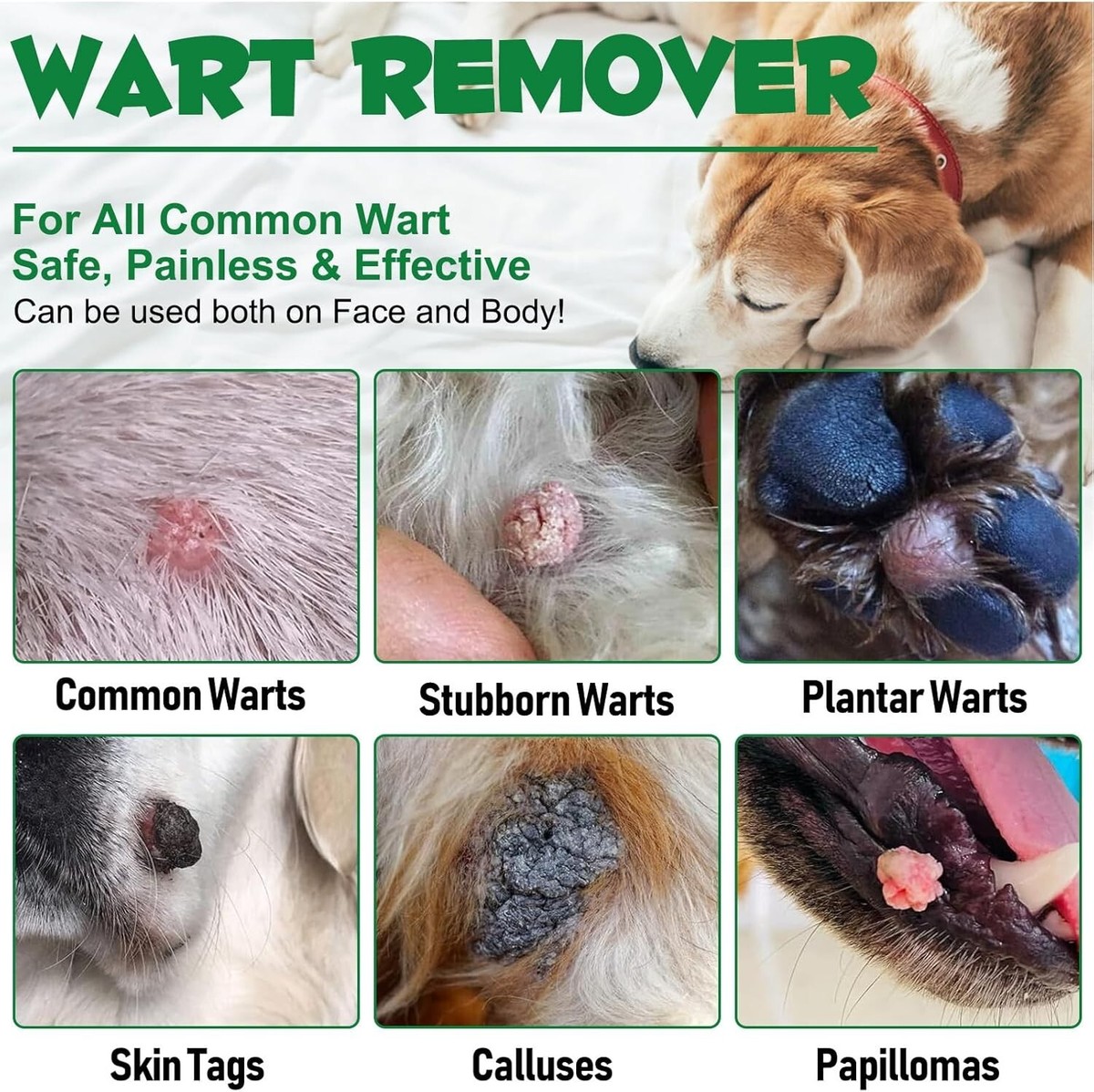 Papilloma Virus Dog Has Wart On Leg Plantar Warts Pictures Of