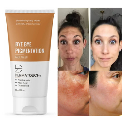 Anti Pigmentation Face Wash for Women/Men with Niacinamide, Kojic Acid - 30G