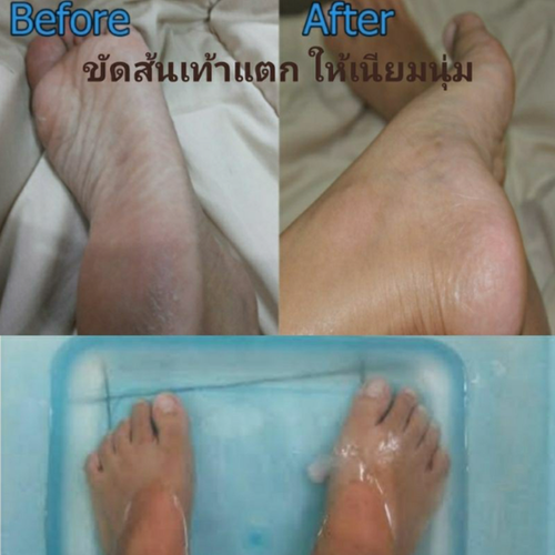 Exfoliating Stone Natural Mineral Stone Cracked Heel Scrub Spa Scurf Rock Clean - Picture 5 of 7