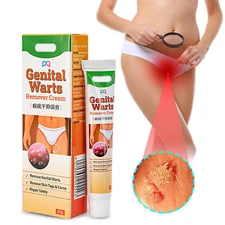 2x Wart Remover Genital Ointment Herpe Cream Acuminatum Antibacterial Treatment