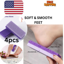 4PCS Pumice Stone Foot Scrubber Callus Remove...