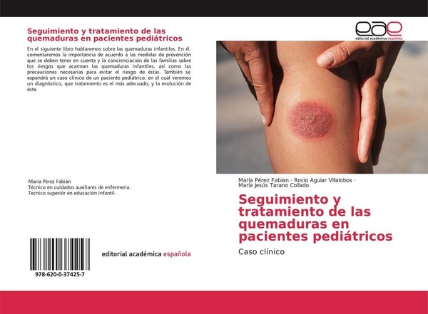 Seguimiento Y Tratamiento De Las Quemaduras En Pacientes PediáTricos MaríA PéRez-image
