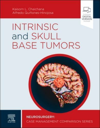 Intrinsic and Skull Base Tumors Neurosurgery: Case Management Comparison Series