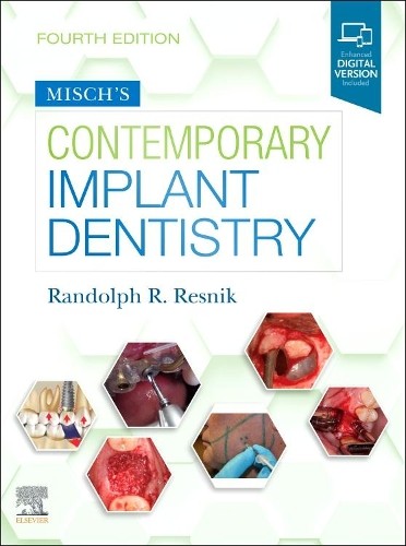 Misch's Contemporary Implant Dentistry by Randolph Resnik - - Image 5