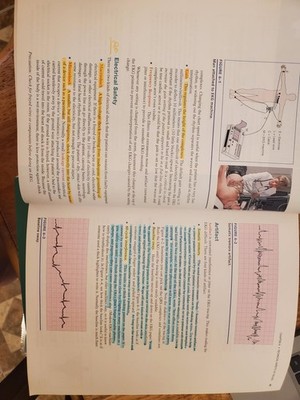 EKG Plain and Simple by Karen Ellis RN