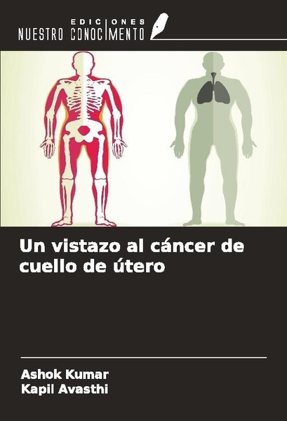 Un Vistazo Al CáNcer De Cuello De úTero Ashok Kumar-image