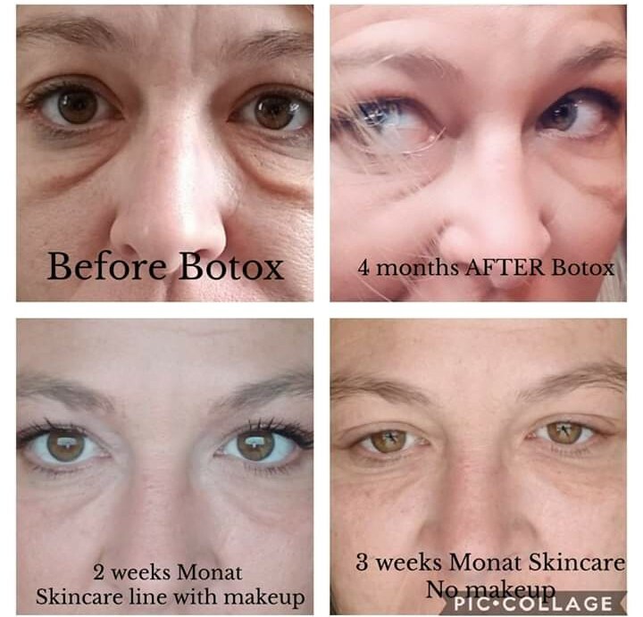 age rewind control nectar monat