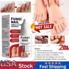 Fungi-Nail Anti-Fungal Liquid Solution Kills Fungus That Can Lead To Nail