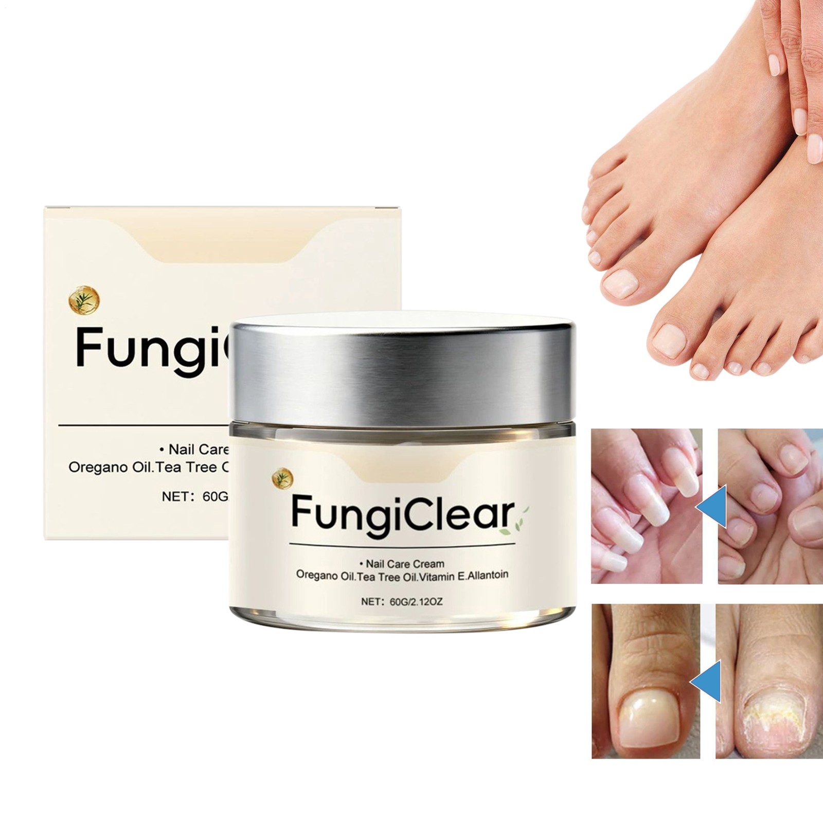 FungiClear Phrena Nail Care Cream With Tea Tree Oil, Oregano Oil, Vitamin E 