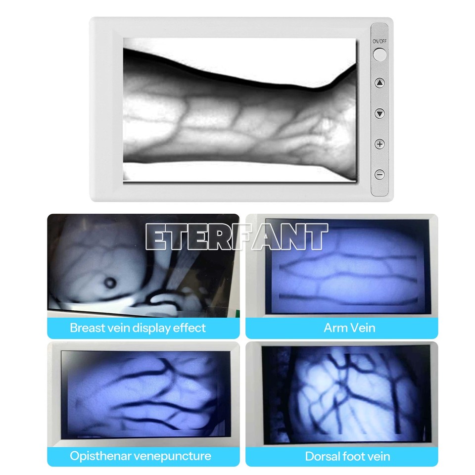 Portable Medical Vein Finder Device Blood Vessel Searching Machine Vein ...