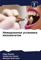 Niru Verma (U. A.) | Nemedlennaq Ustanowka Implantatow | Taschenbuch | Russisch