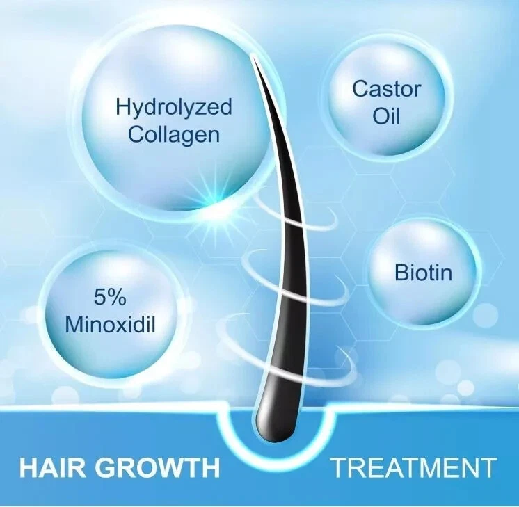 5% Minoxidil Hair Growth Spray for Men & Women - 2PCS Hair Regrowth Solution - Image 4 of 4