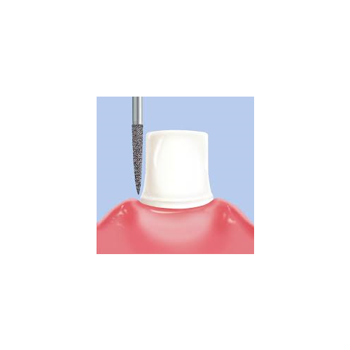 Abrasive Technology Two Striper FG 770.8 Round End Taper Coarse - Foto 4