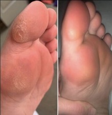 Nu Skin Epoch Sole Solution Foot Treatment - 01001988