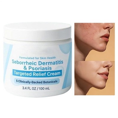 Seborrheic Dermatitis & Treatment Cream Beard Recovery Cream